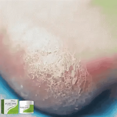 South Moon - 42% Urea Feet Cream (Original)