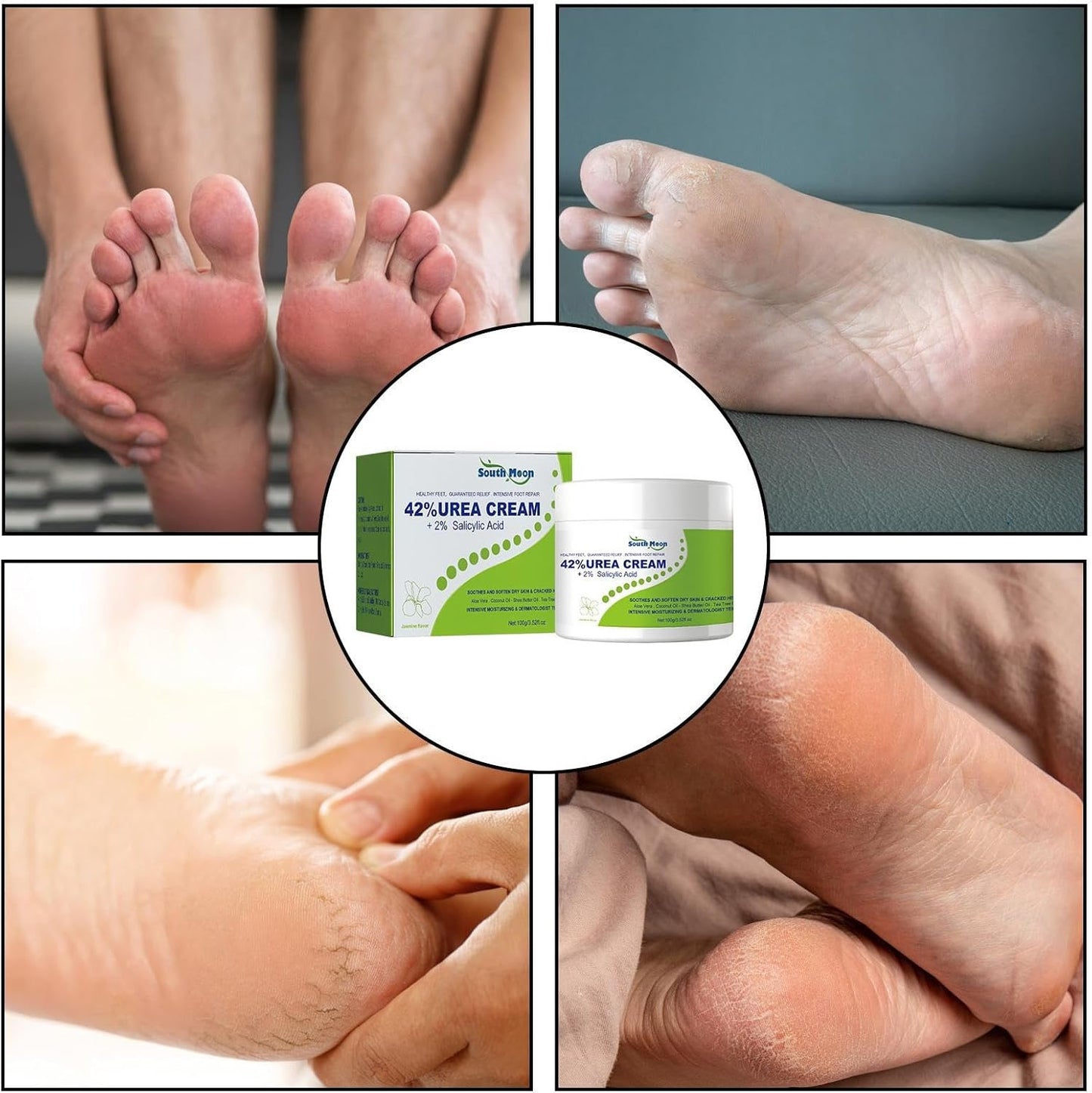 South Moon - 42% Urea Feet Cream (Original)